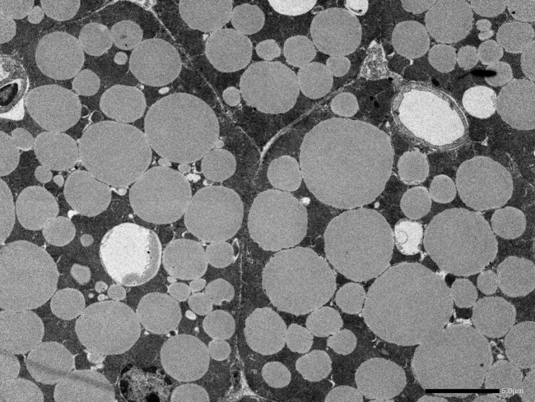 该屯点脂肪过冬了