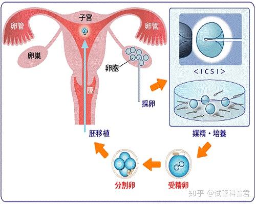 子宫偏小能做试管吗 知乎