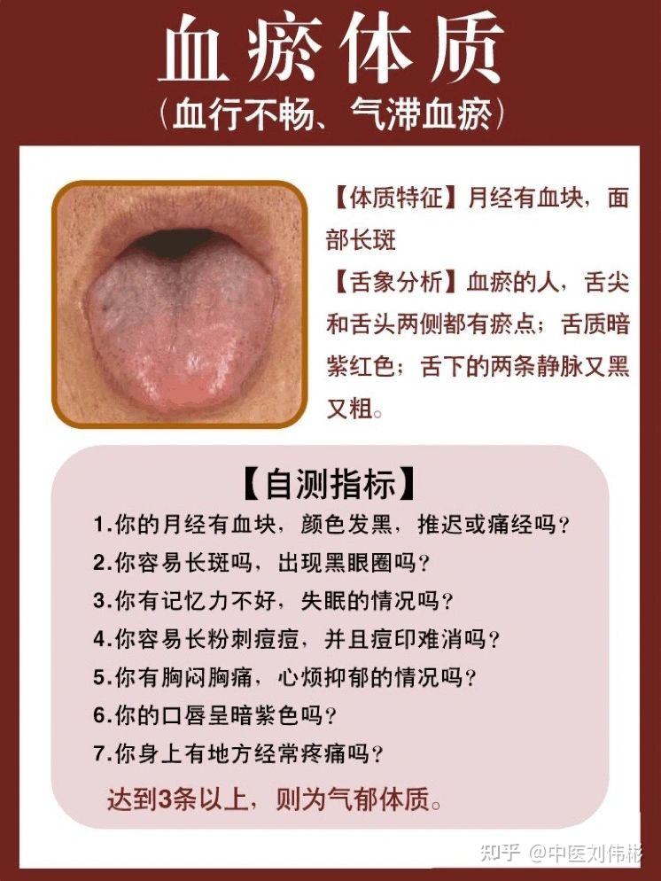 03 血瘀体质(血行不畅,气滞血瘀)