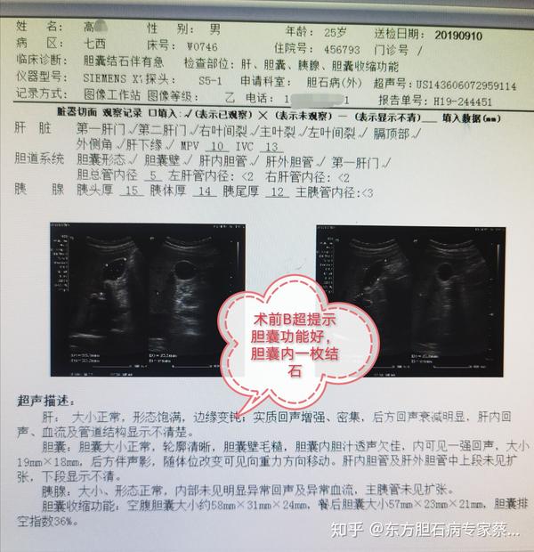 射胆猎手专家专栏图片