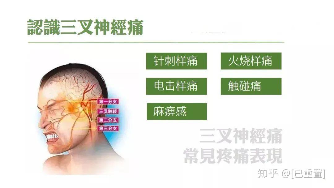 但女性是男性的2到3倍雖然男性也會有三叉神經痛三叉神經多發於女性偏