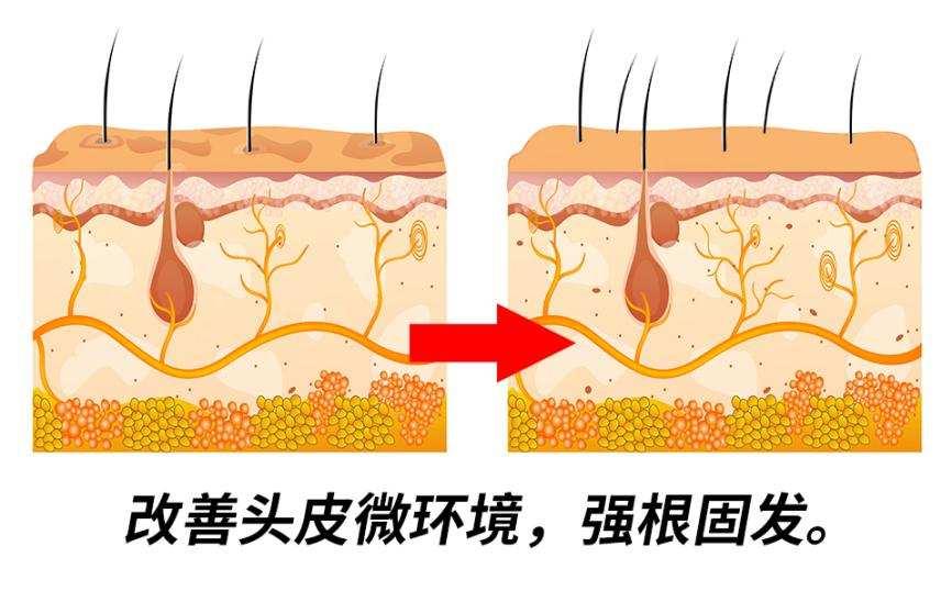 乐喜力丝能抑制头皮皮脂腺分泌过多油脂,改善头皮发炎现象,清除头皮有
