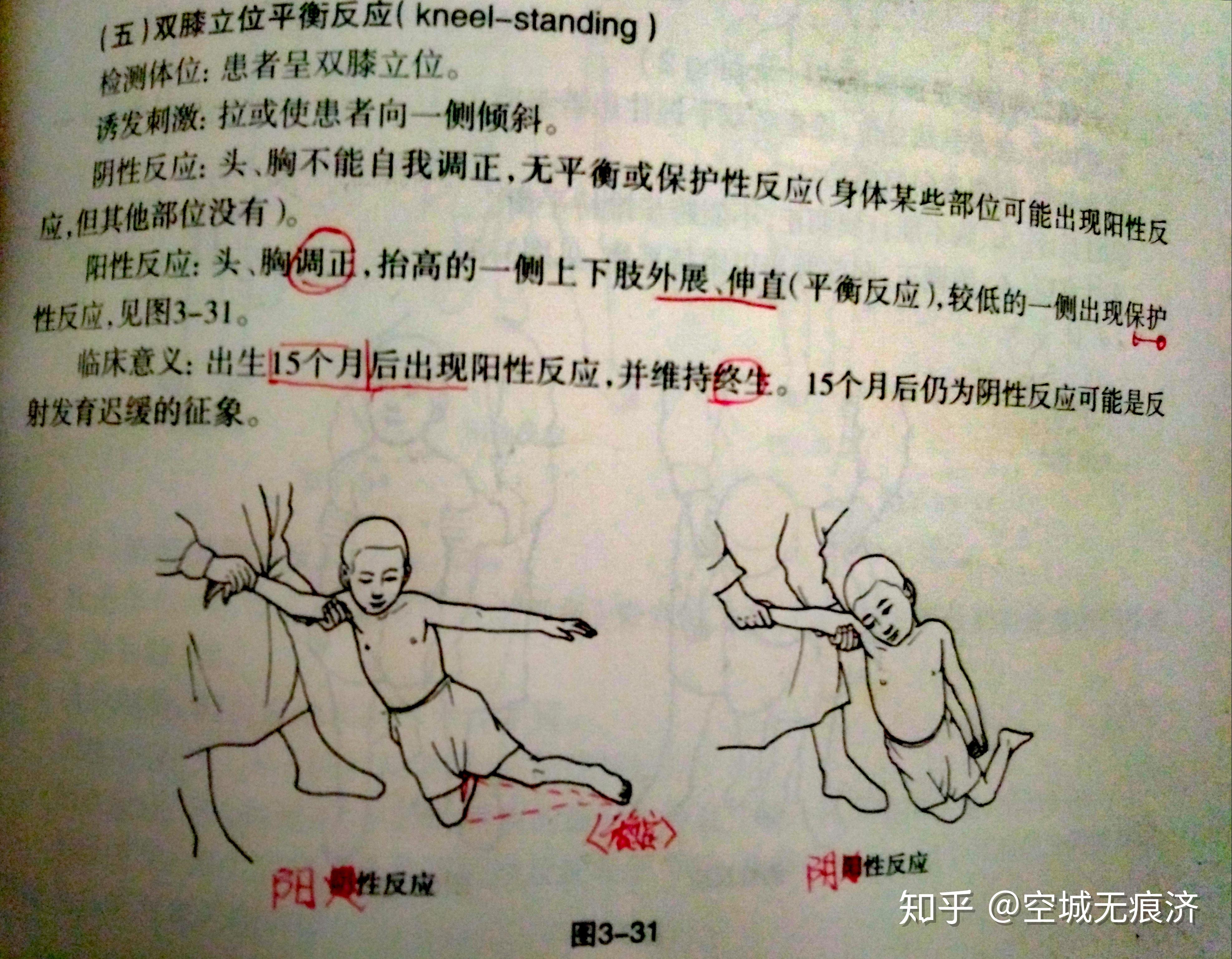 阴性反应:头和胸不能自我调正,无平衡或伸展反应.