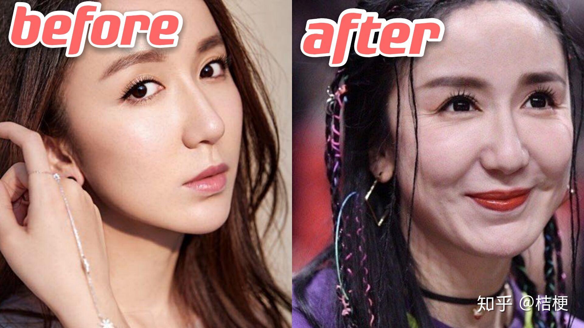 王子文填充后越来越少女了最会填充的女明星