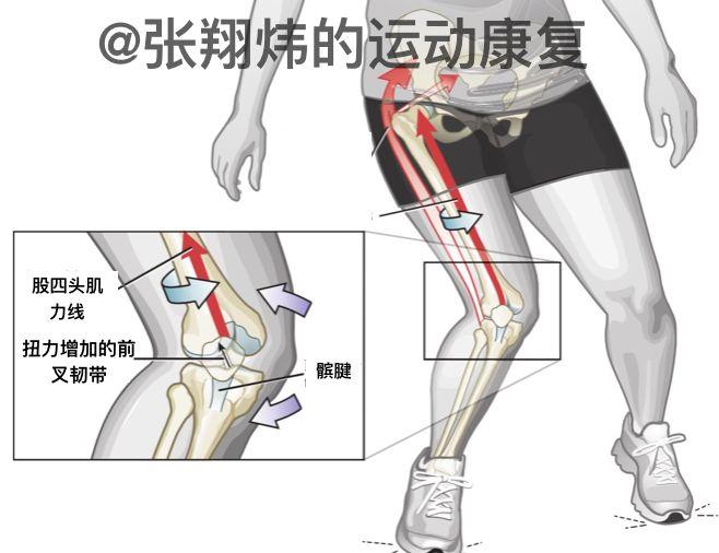301醫院的醫生說要練靜蹲,要利用大腿前側(股四頭肌)分擔前交叉韌帶