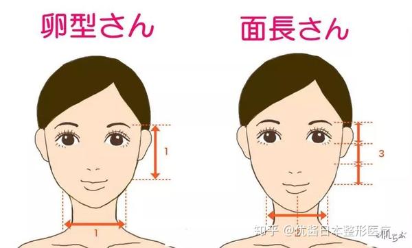 嗨 有一份长脸星人的整形指南等你签收 赴日医美 知乎