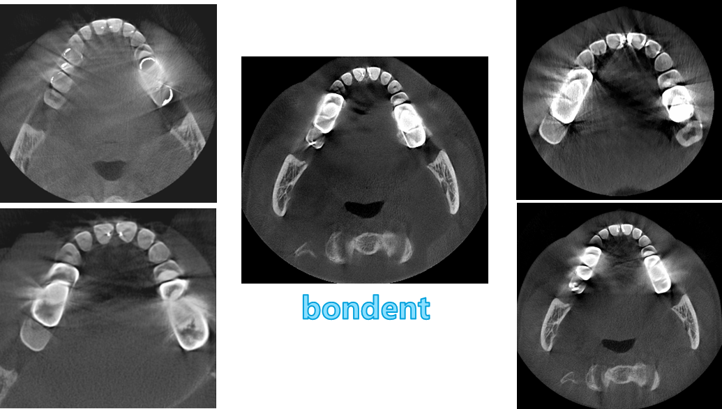 伯爵cbct影像篇⑦产品特点