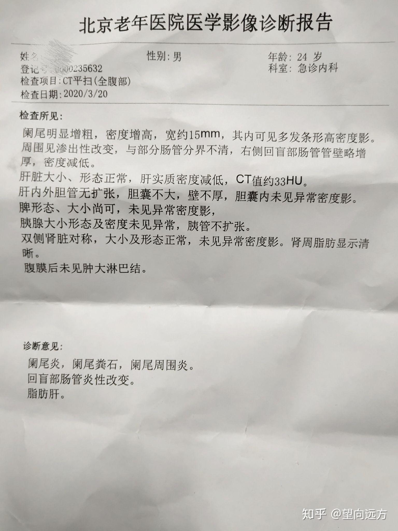 阑尾炎CT报告图片