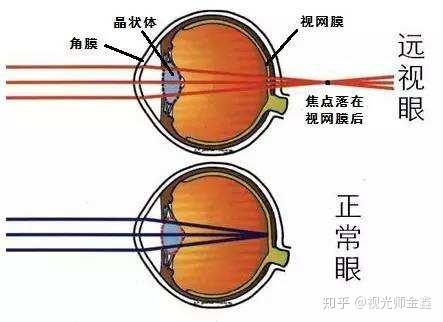 近视镜是运用什么原理_幸福是什么图片