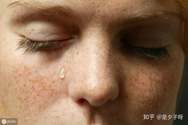 天天用美白精华脸还是暗黄的我怀疑我病了如何解决皮肤暗黄