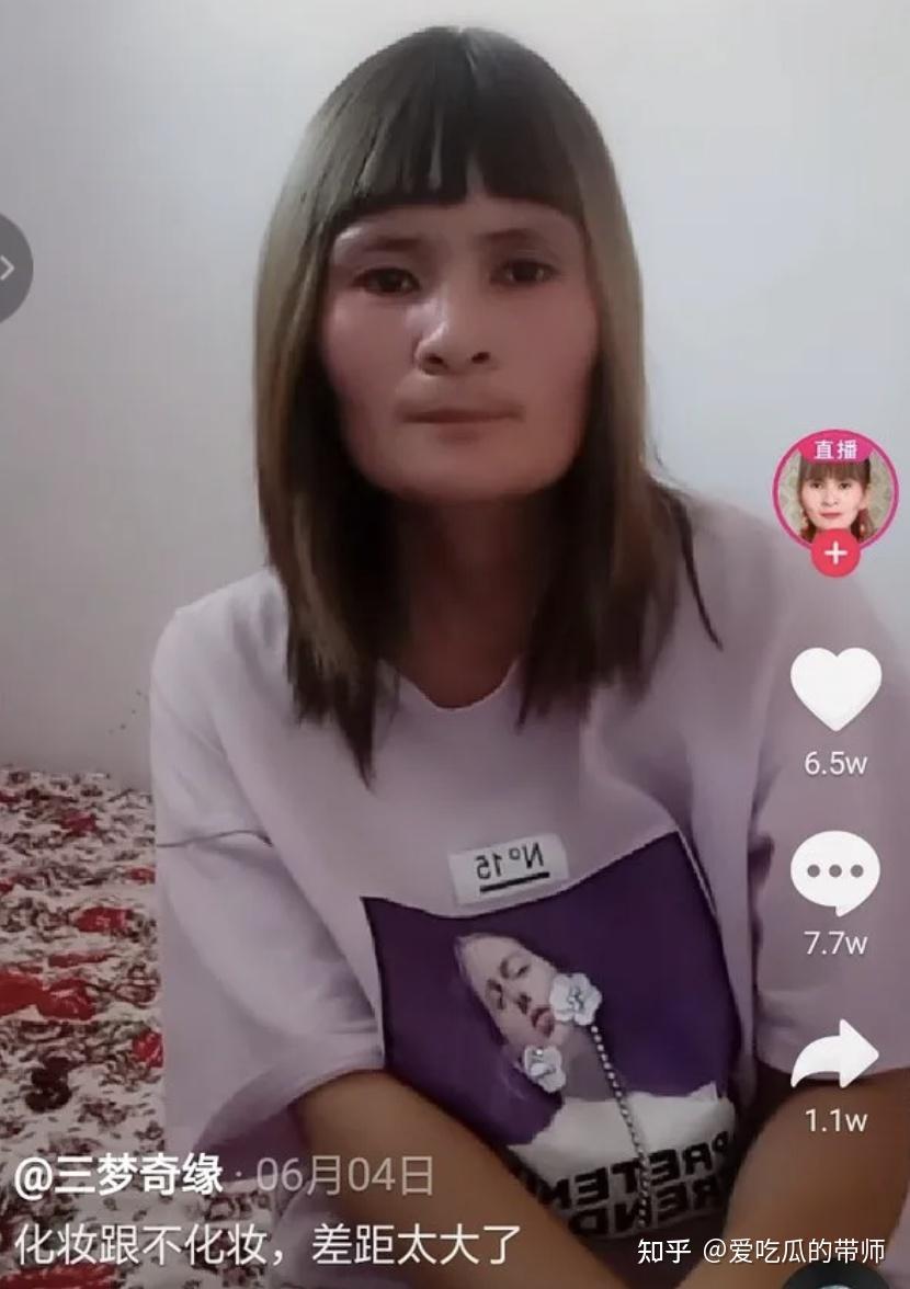 的还有审丑的网红模式,例如下面的这位女明星,是一位克鲁宗综合征患者