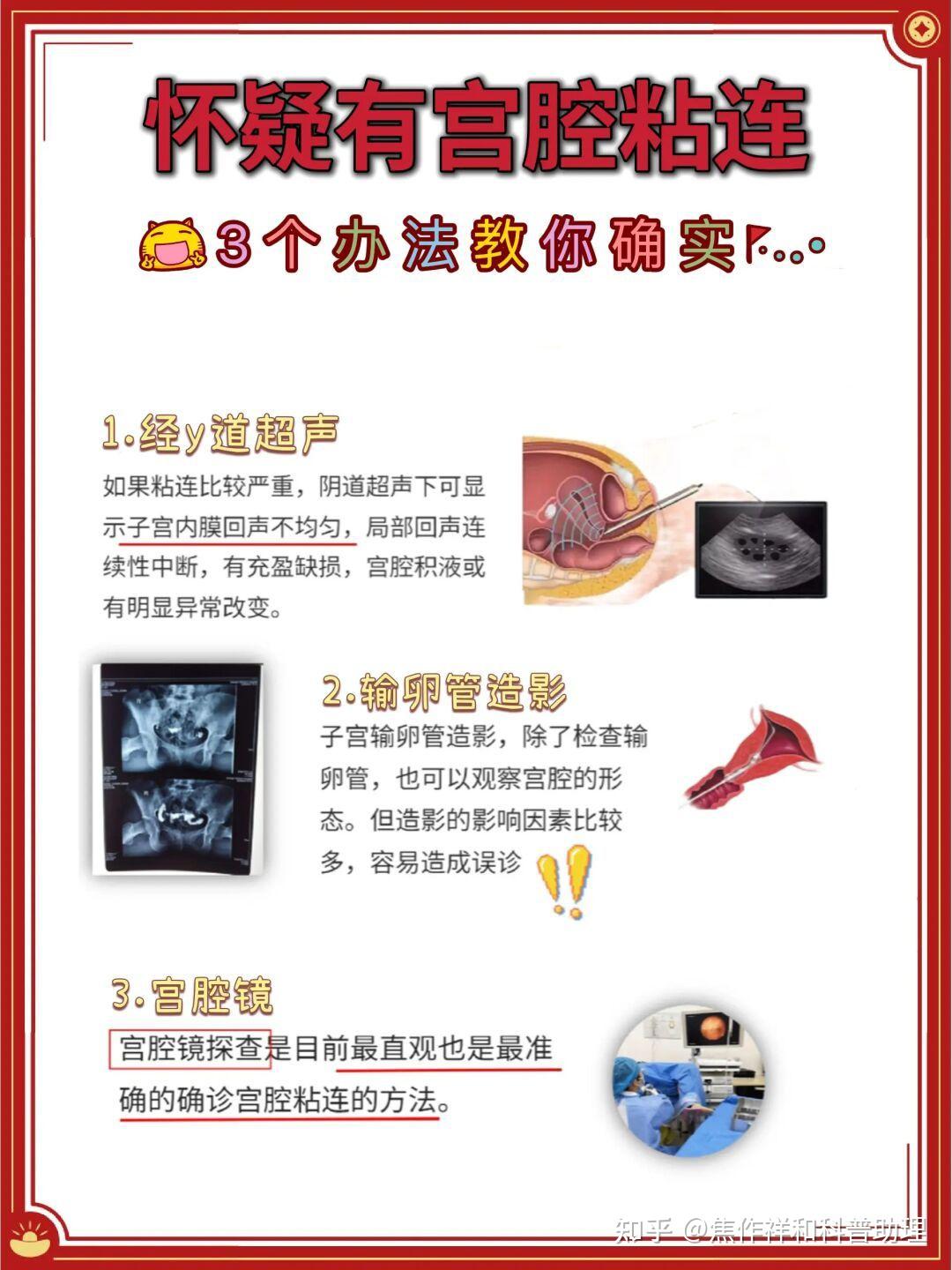 想知道自己是不是宫腔粘连? - 知乎