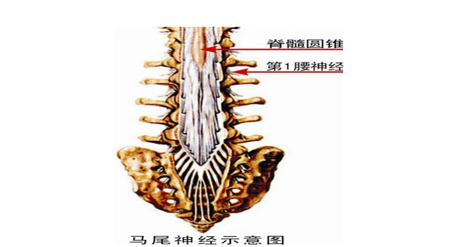 马尾神经损伤患者的必要须知