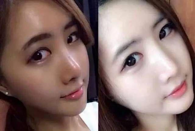男女晒黑后迅速变白的方法