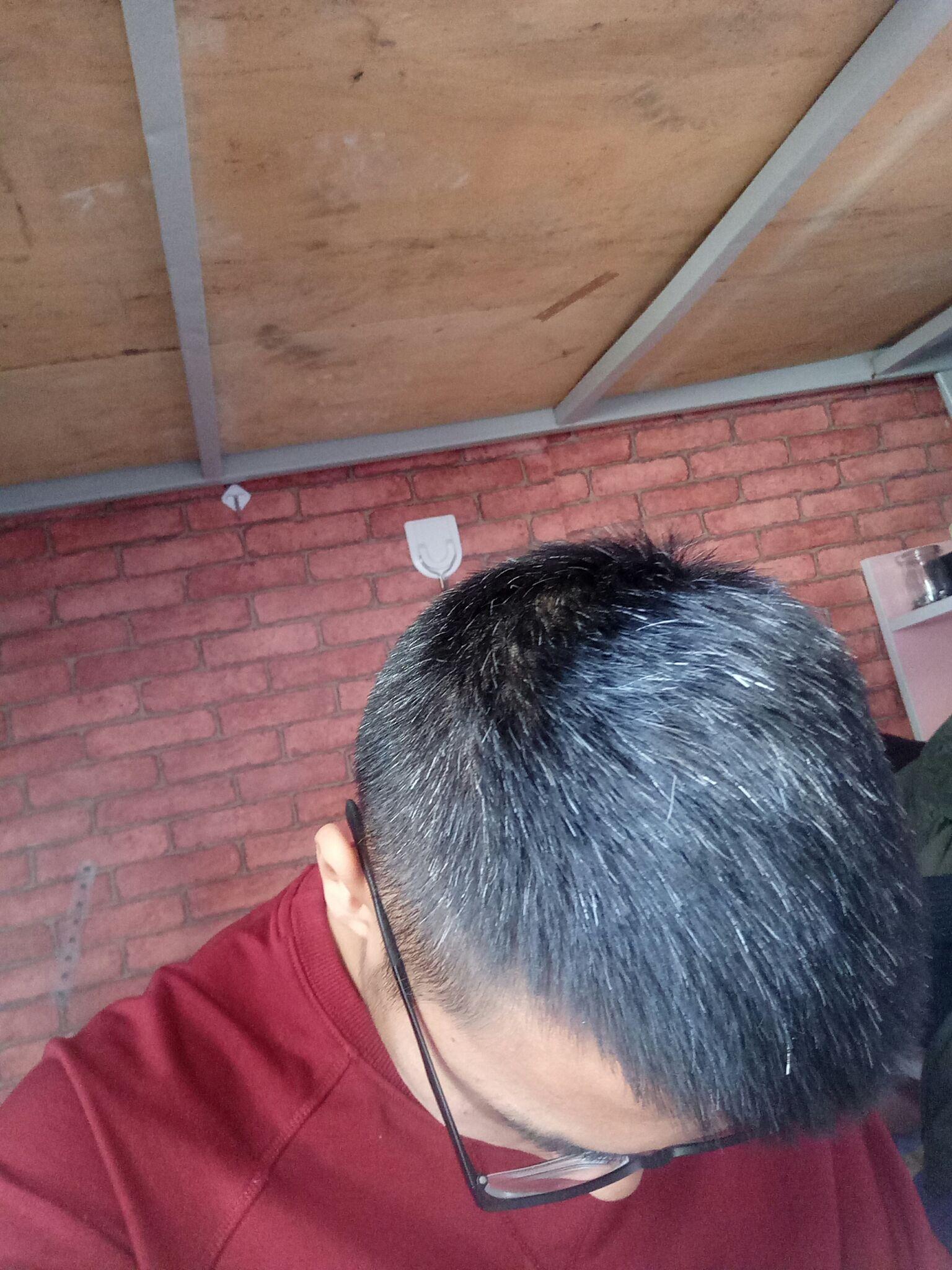 有少白头是怎样一种经历