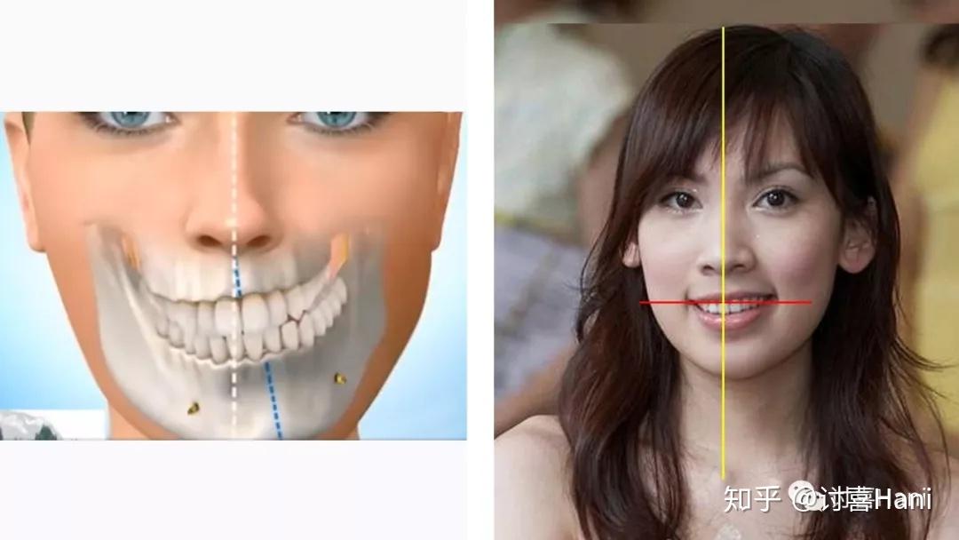 总结了10种大脸,脸大自救指南拿好不谢 - 知乎