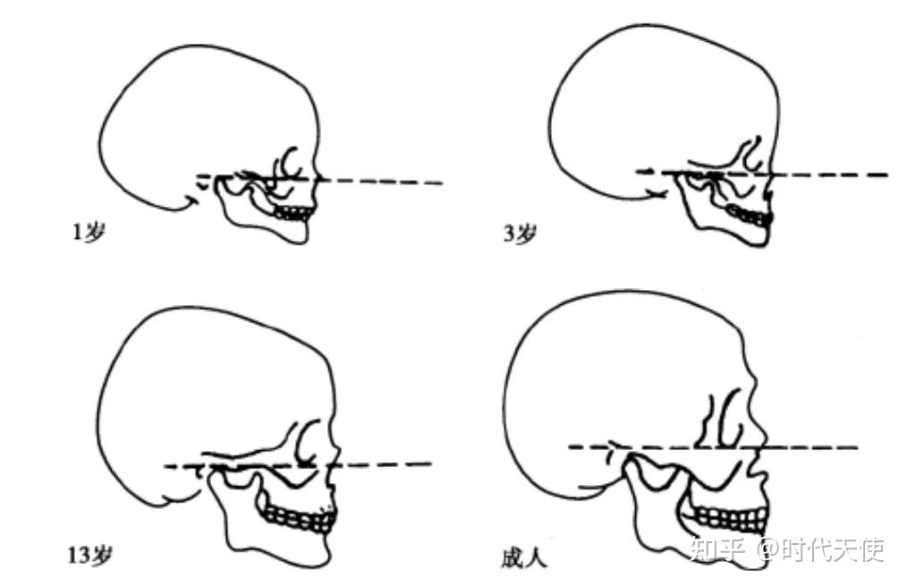 要搞清楚这个问题,首先我们要了解一个概念:颅颌面的生长发育.