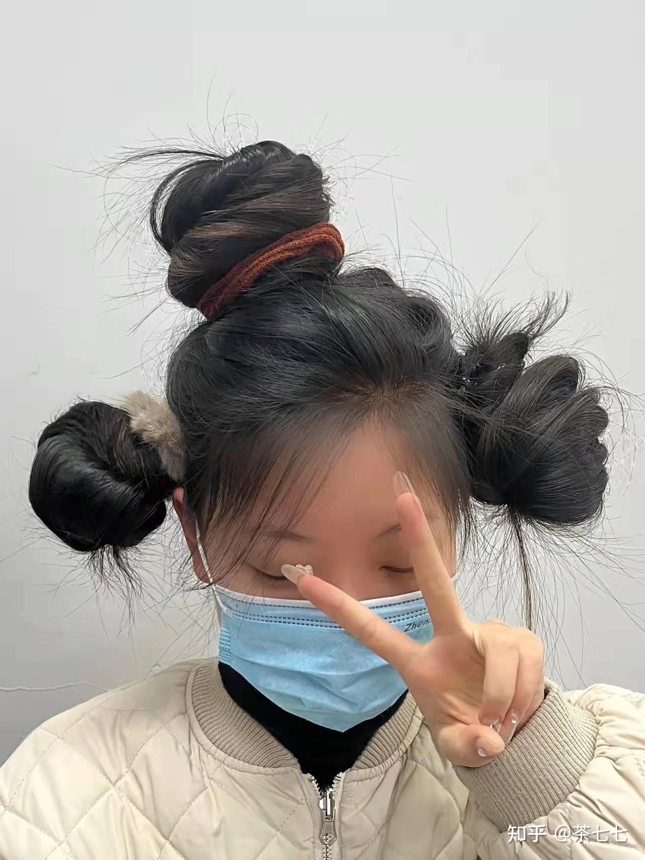 如何增加头发?怎样成为发量王者! - 知乎