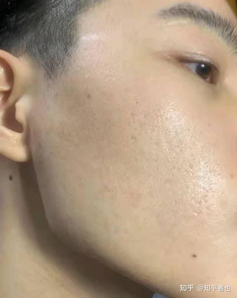 我是男生皮肤暗黄黑怎么能让皮肤变白