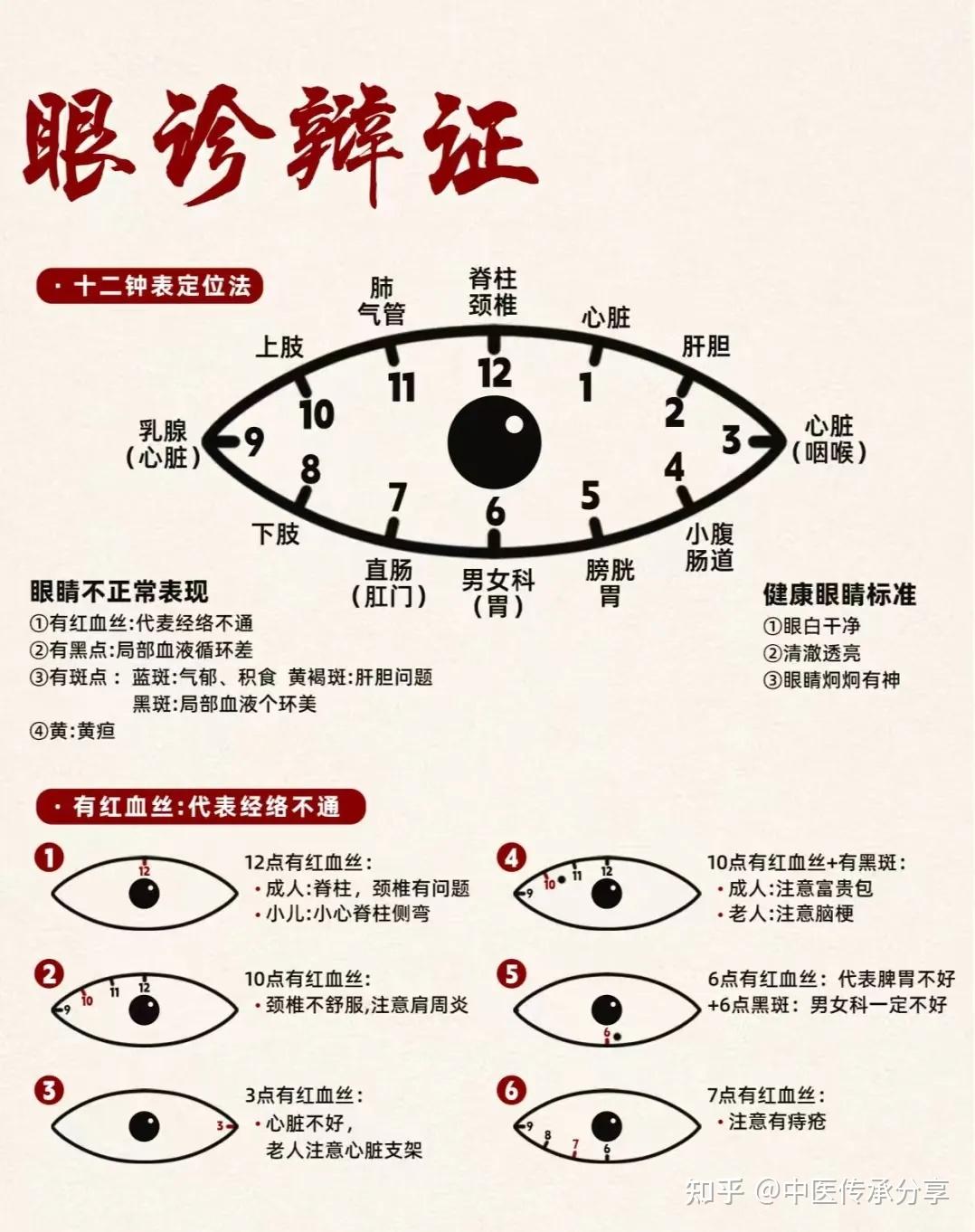 中医眼诊!(超全整理) - 知乎
