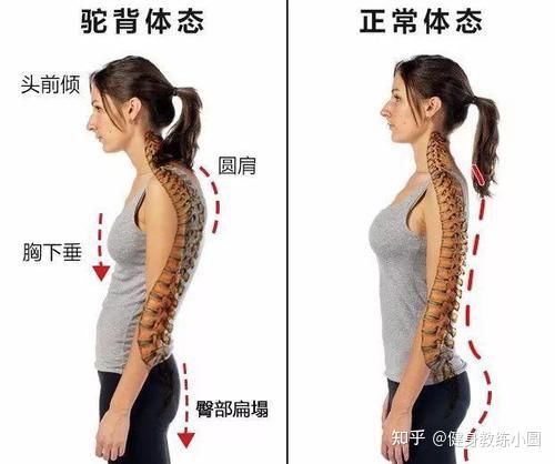 怎么解决背厚问题？让背部变薄变美 - 知乎