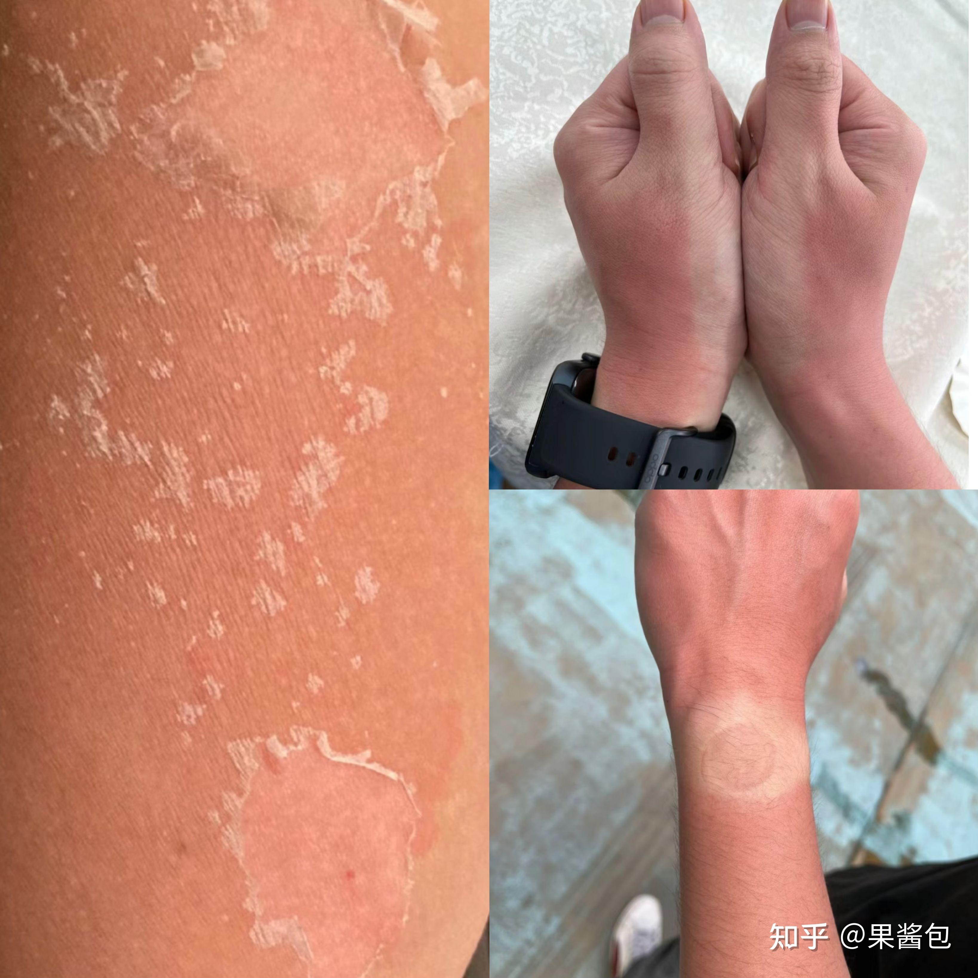男生穿防晒衣很娘吗?