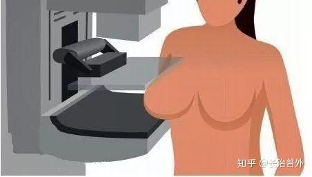 乳腺检查啥时候做超声啥时候做钼靶