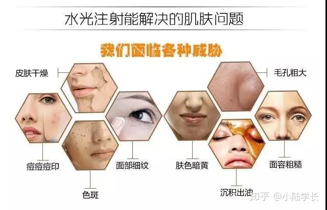 "水光针"——你需要明白的小科普