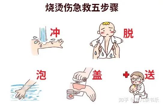 孩子烫伤后怎么办这些急救措施家长要知道建议收藏