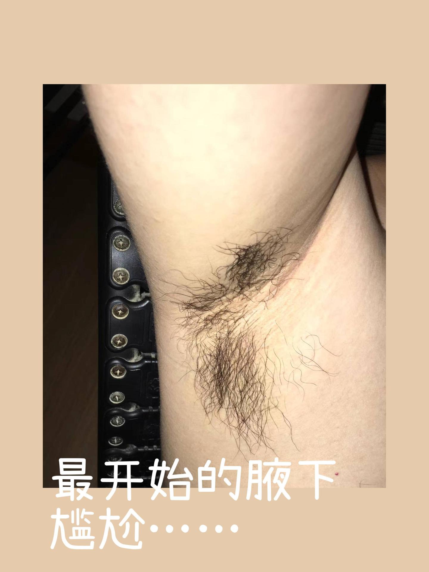 神仙脱毛仪 现在我是见人就安利 知乎 神仙脱毛仪 现在我是见人就安利 知乎