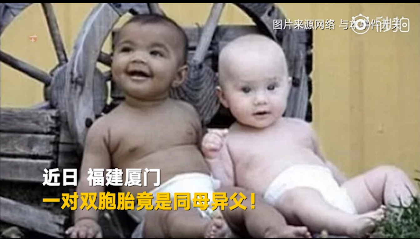 厦门同母异父双胞胎,双胞胎有两个爹!