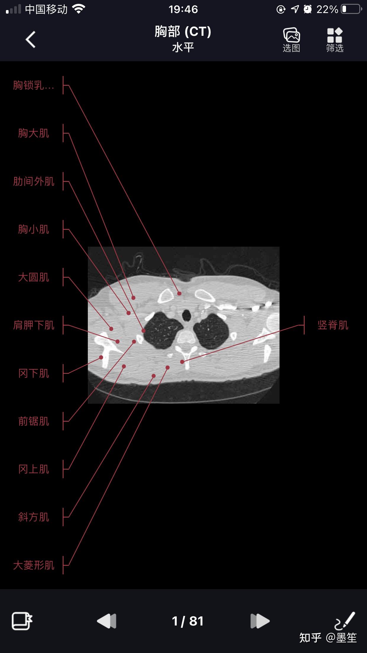 影像学习必备软件影像解剖图谱