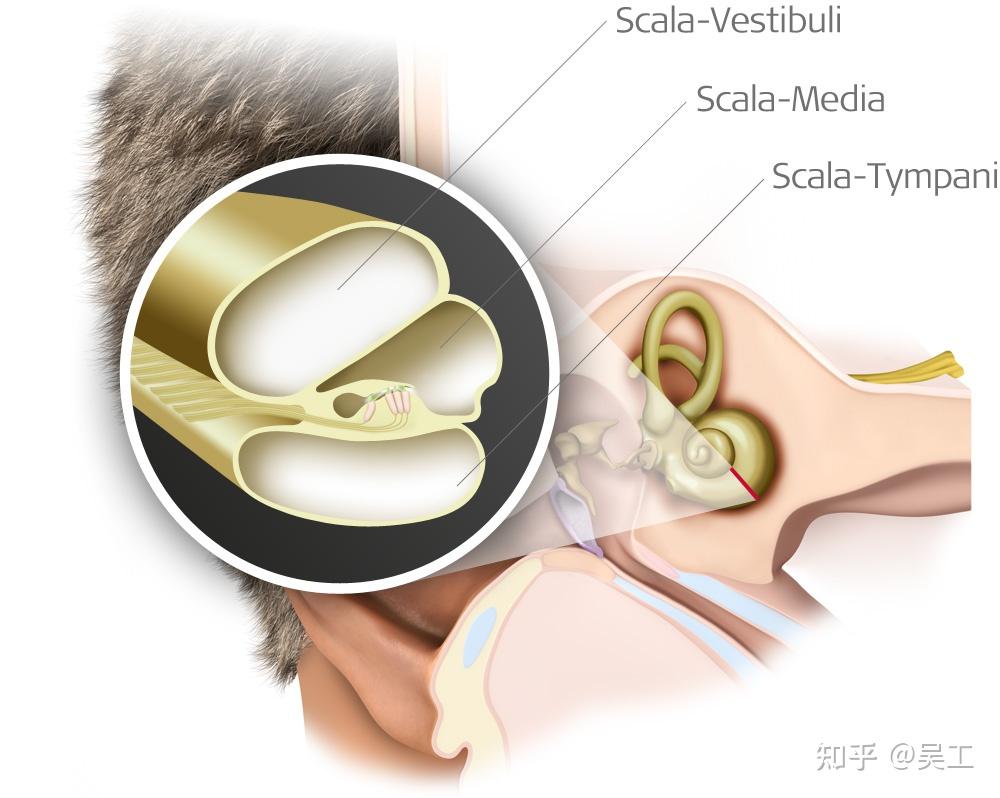 耳蜗剖面有3个管腔,分别为:鼓阶,前庭阶和蜗阶(人工耳蜗电极植入鼓阶)
