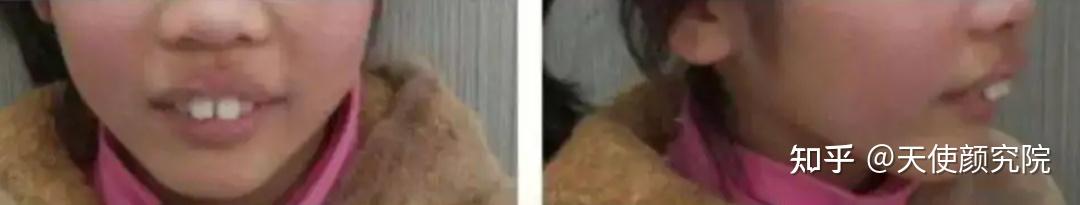 郑秀妍这段太蛊了吧!芒果台怎么能删了不播??!(郑秀妍签约英皇)