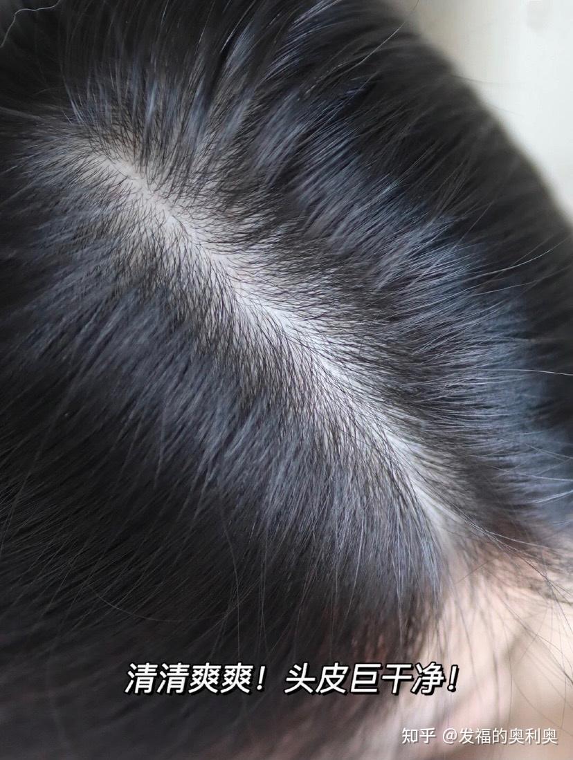 怎样养出一头浓密秀发?