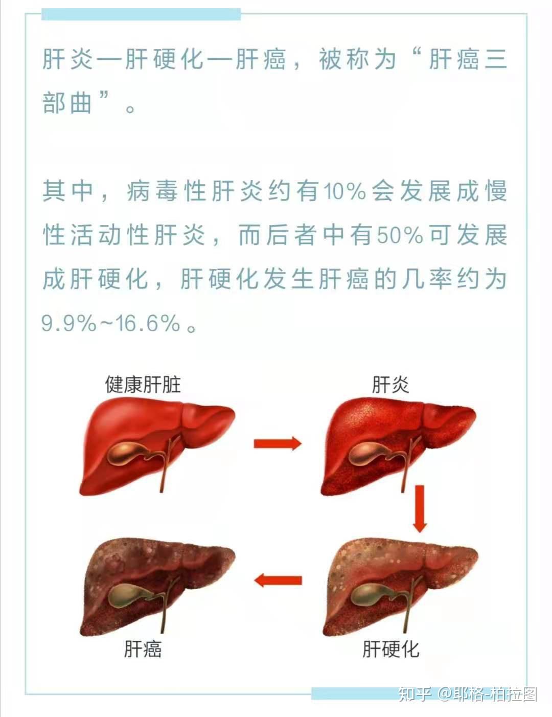 90肝癌患者都感染了这种病毒想养好肝先做对这6件事