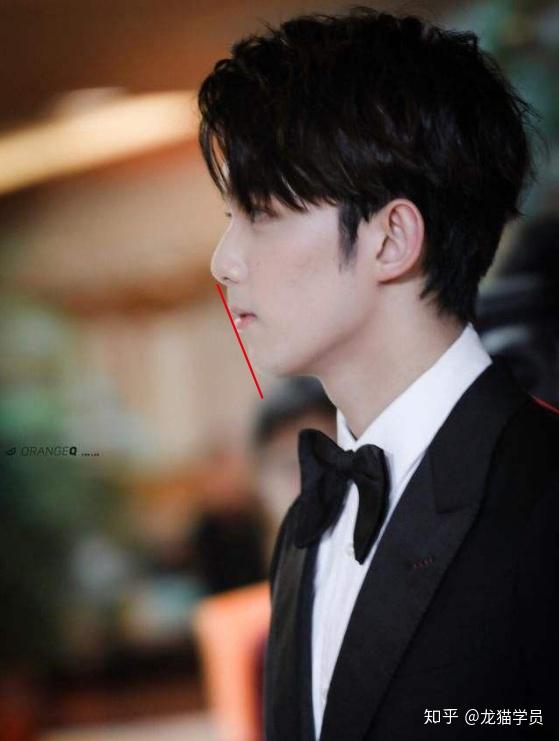 有哪些明星有颌面问题比如地包天