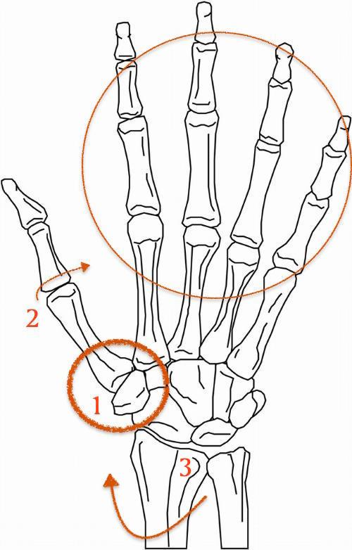 弹钢琴时大拇指关节内陷如何纠正
