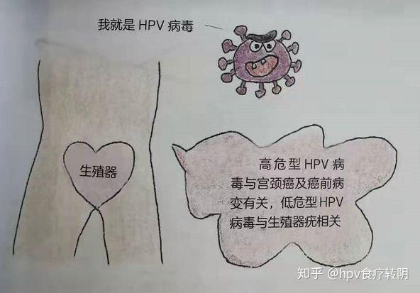 什么是高危型hpv什么是低危型hpv