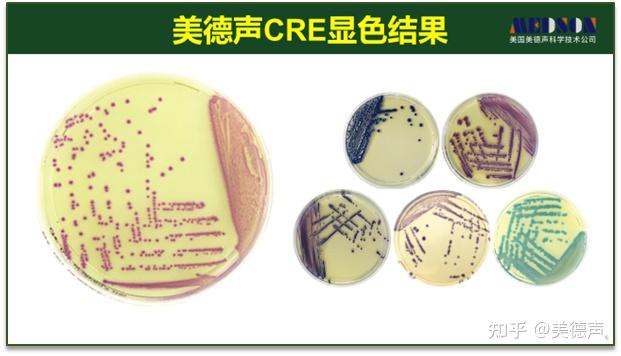 超级细菌持续来袭!!!CRE显色培养基助力碳青霉烯耐药革兰阴性杆菌感染和预控! - 知乎