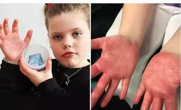 警惕这种玩具内含毒硼砂你家有吗