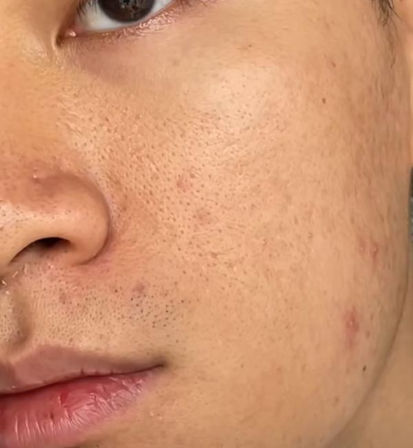 皮肤暗沉发黄?用对美白成分完成抄近道似美白!