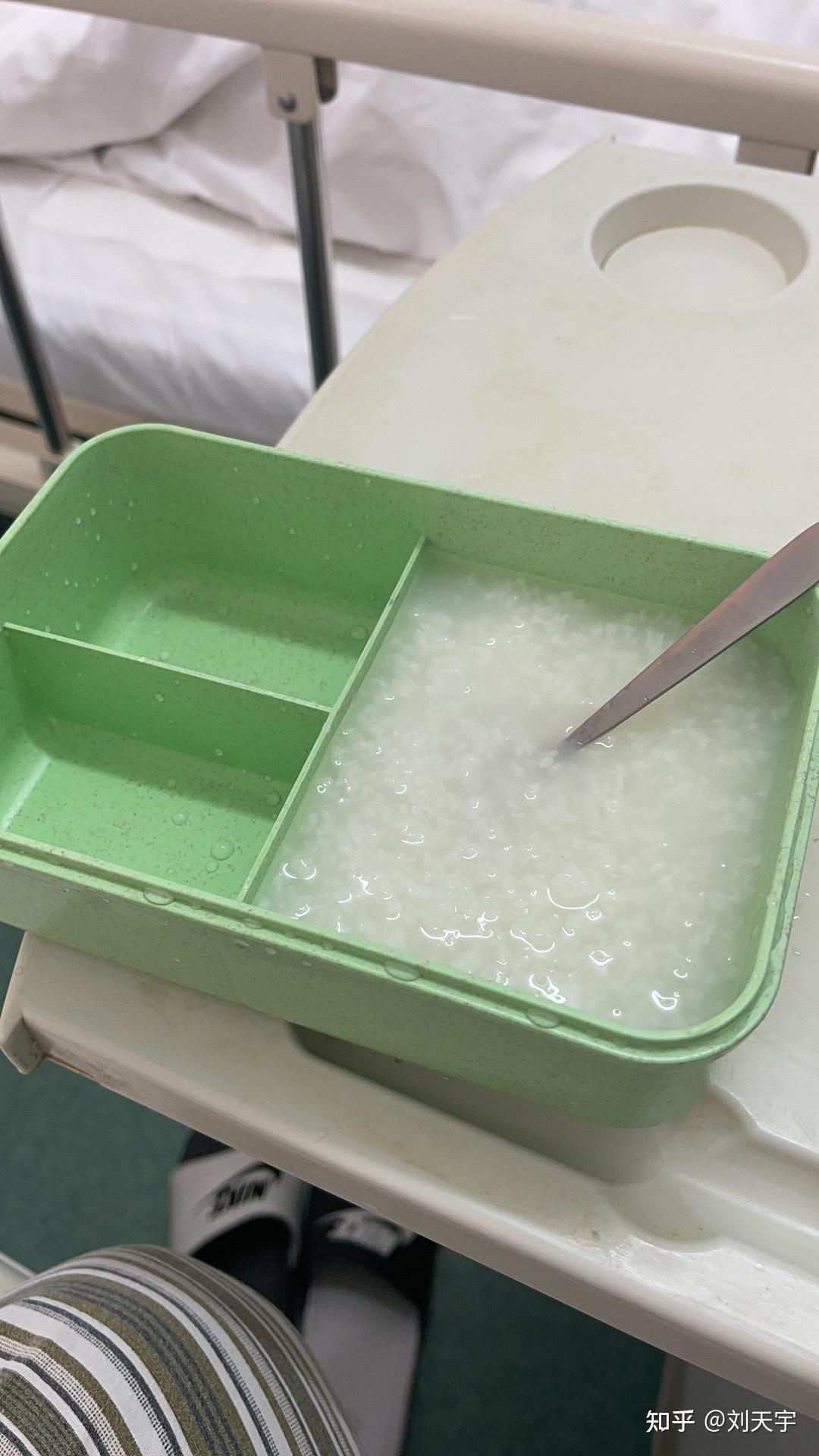 量体温 喜提稀饭一碗(为了第二天肠镜)8点半到医院 找主刀