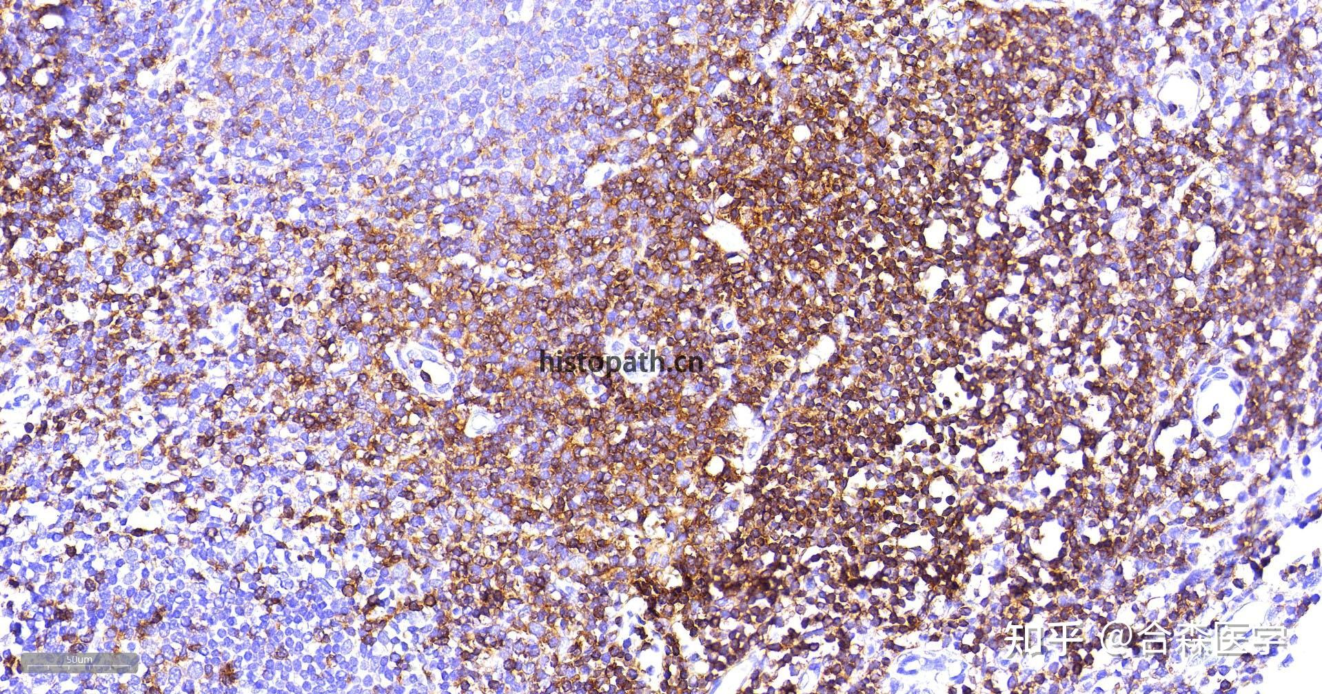 免疫组化（IHC）实验操作技术指南 - 知乎