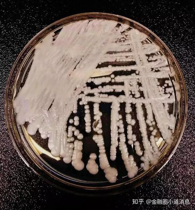 已有 18 例确认感染的「超级真菌」耳念珠菌是