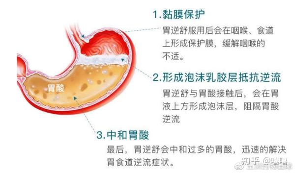 莫名其妙地呕吐、反酸，按胃病治疗胃食管反流，为什么还是反复发作？ - 知乎