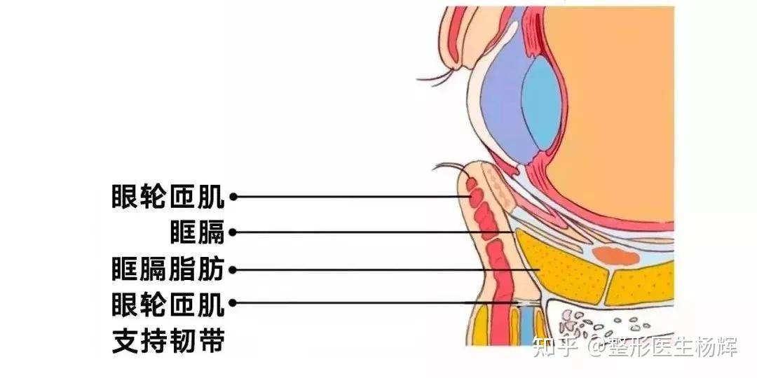 什么是眶隔脂肪释放术？ - 知乎