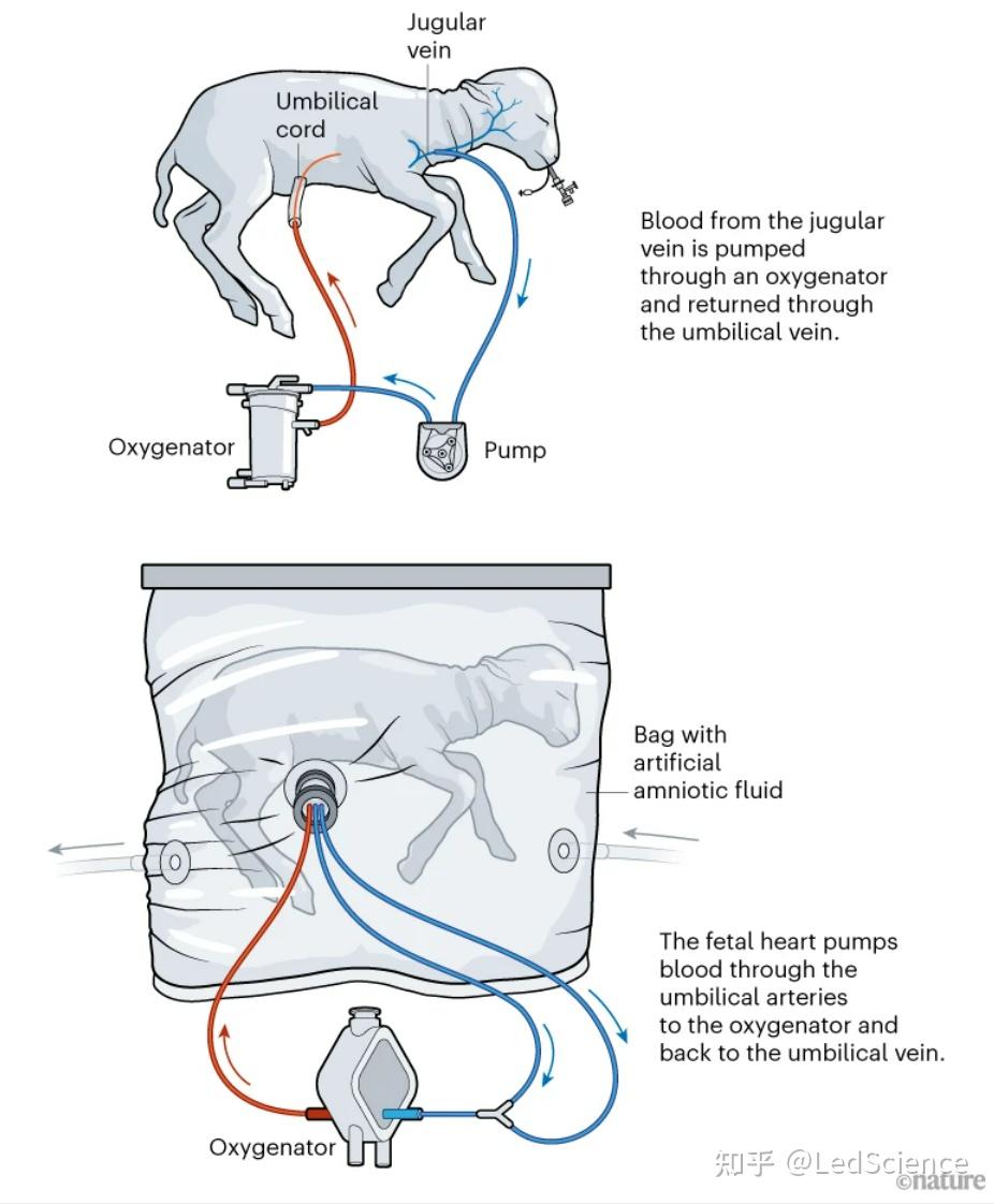 人造子宫技术有突破，是否批准人体实验引发伦理争议- 知乎