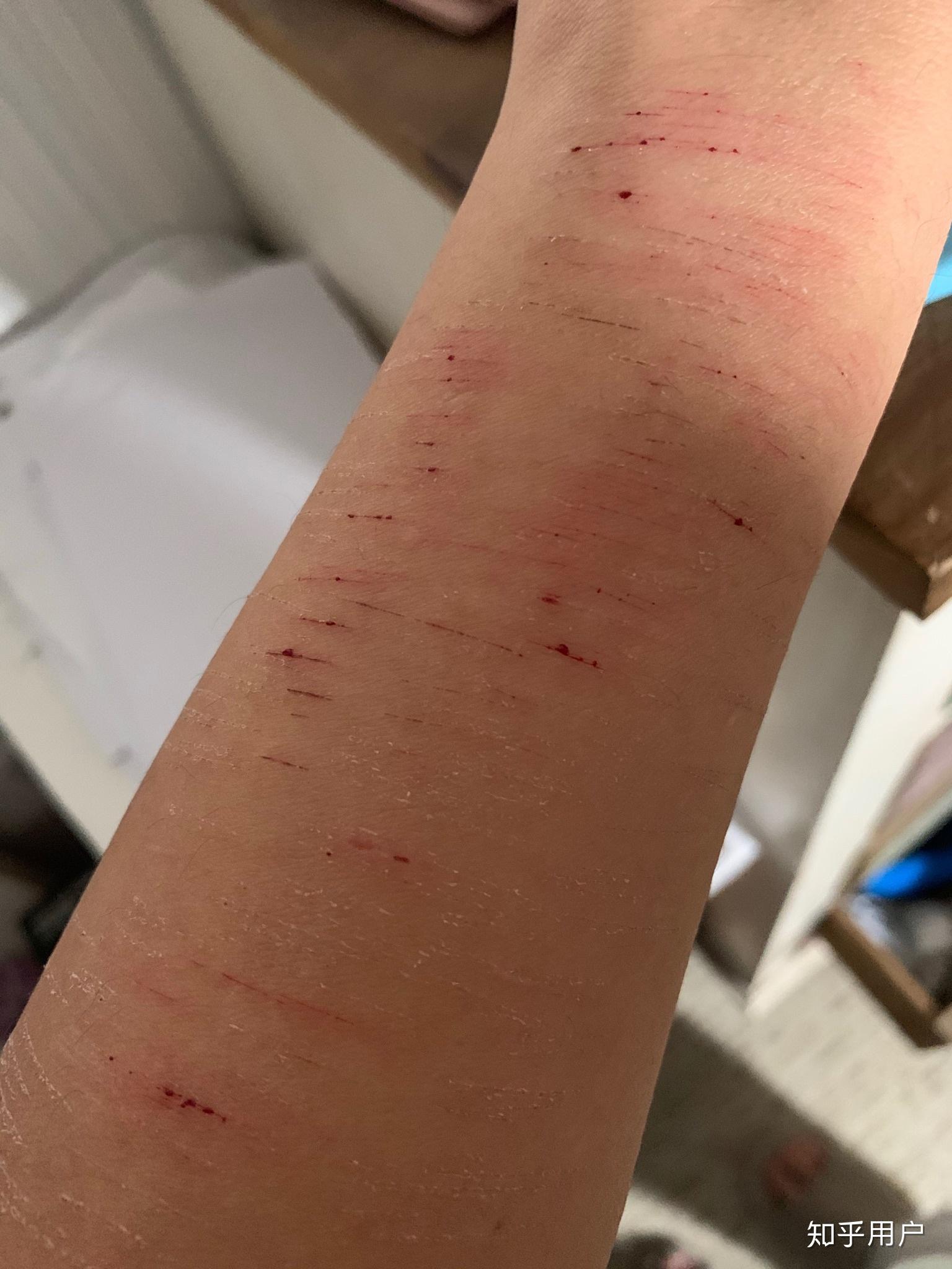 自残属于什么心理