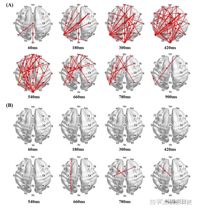 Cerebral Cortex：调节γ振荡可以促进大脑连接性而改善认知障碍 - 知乎